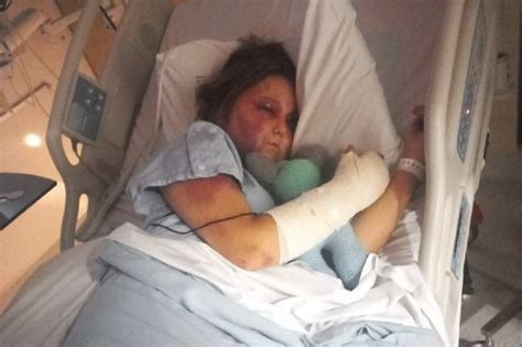 kirra hart getting beat up video|Teenage victim of savage Queensland beating speaks ...